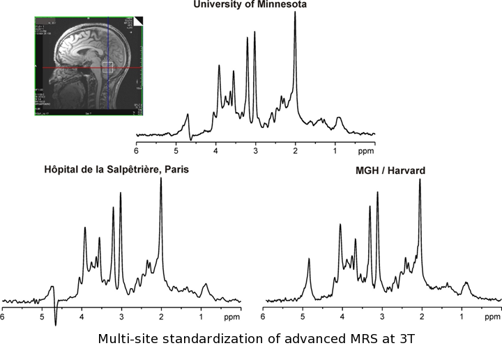 mrs-biomarker-image.png