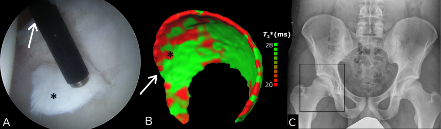 msk-cartilage-results-900.png