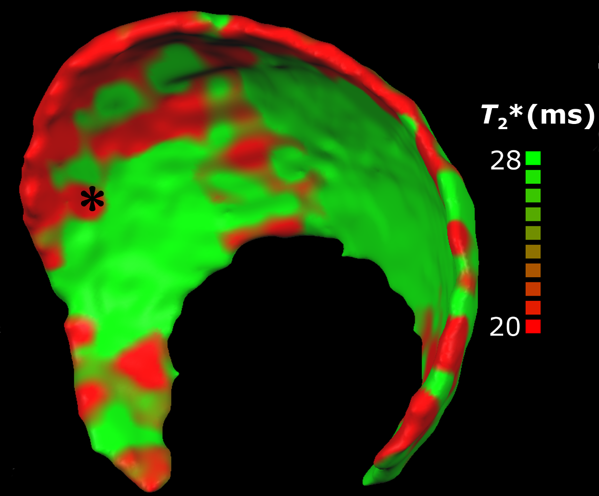 msk-cartilage.png